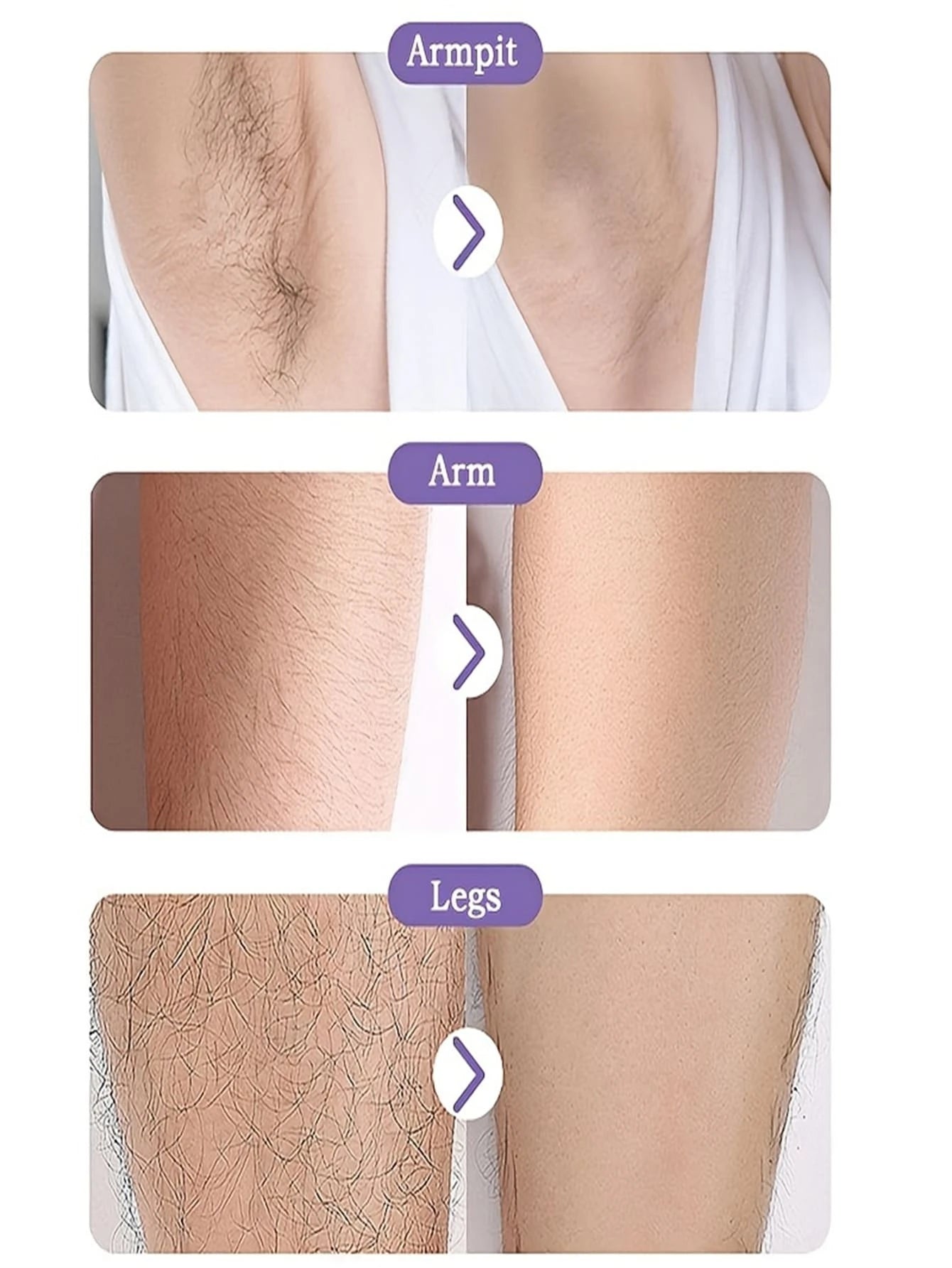 Nano Glass Grinding Hair Removal Device, Creative Physical Depilation Exfoliating Tool, Harmless To Skin