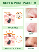 SlowSunday Green Tea Blackhead Remover Pore Strips